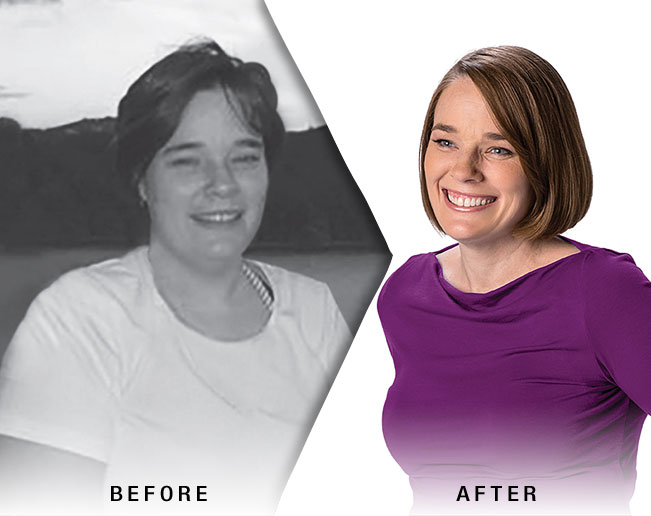 Before-and-After-Kellie